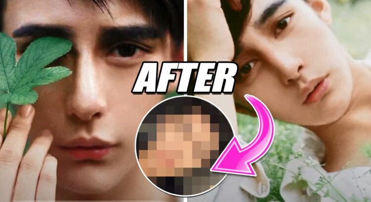 An Actor Reversed His Extreme Plastic Surgery, Now He’s A Heartthrob