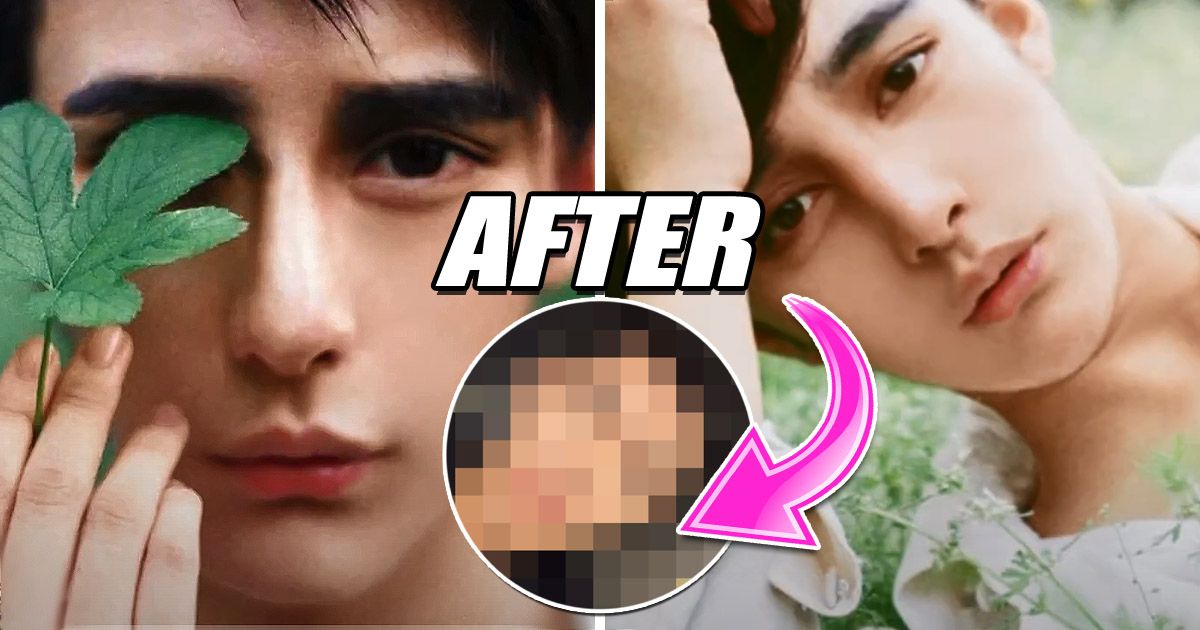 An Actor Reversed His Extreme Plastic Surgery, Now He’s A Heartthrob